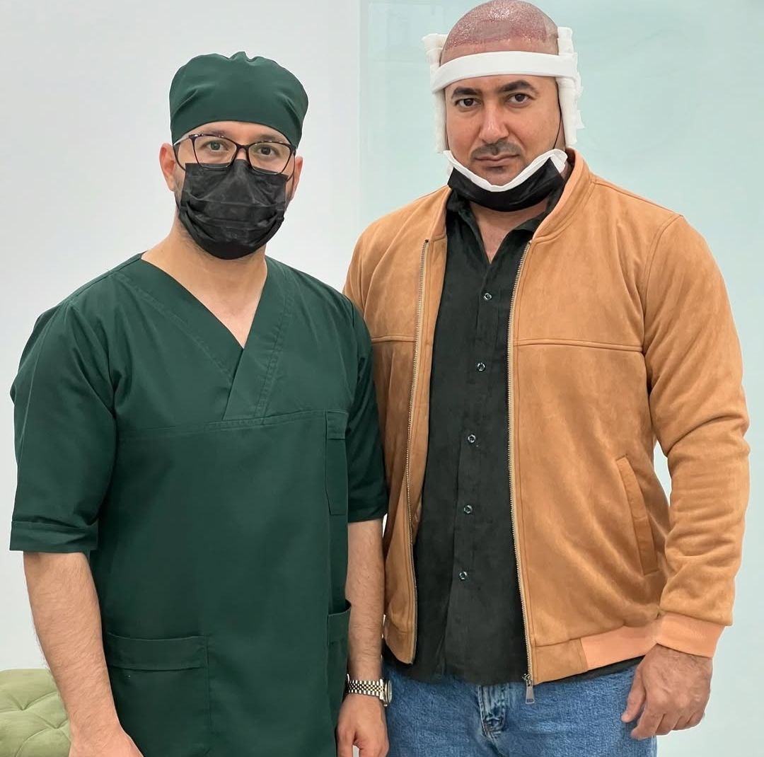 hair transplant