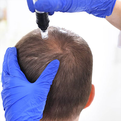 mesotherapy